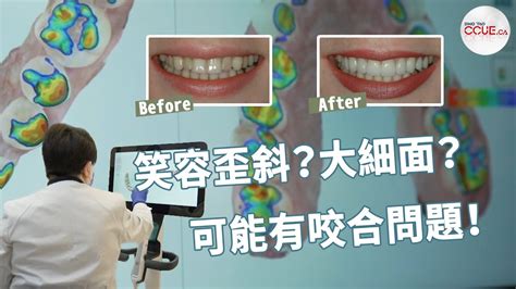 牙齒歪斜|牙齒歪斜問題？